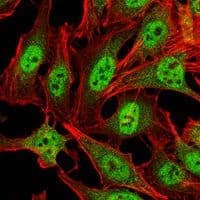 Monoclonal Mouse anti-Human PRMT4 / CARM1 Antibody (clone 3H2, IHC, IF, WB)
