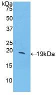 CSF3 / G-CSF Antibody (aa34-193)