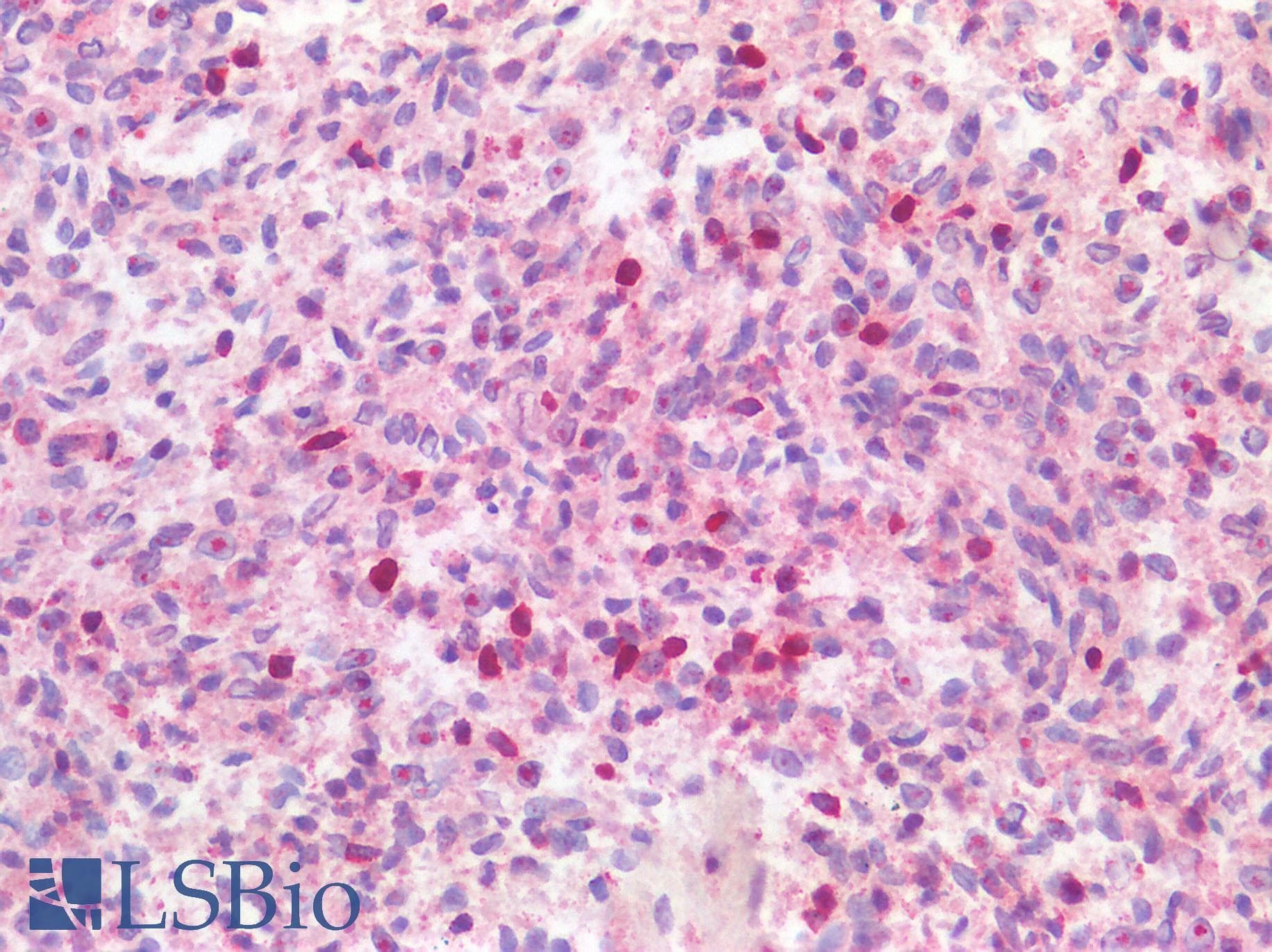 Polyclonal Rabbit anti-Human GZMK / Granzyme K Antibody (IHC, IF)