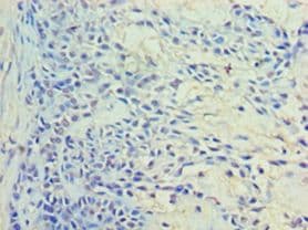 RAB11A Antibody (aa2-213)