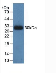 PathPlus™ IDH1 / IDH Antibody (clone C13)