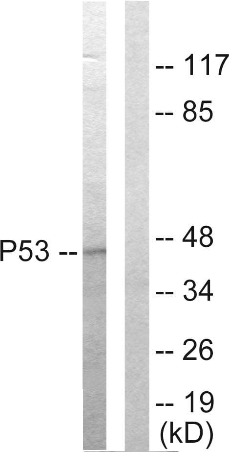 TP53 / p53 Antibody