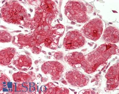 IHC-plus™ Polyclonal Rabbit anti-Human MAP1LC3 Antibody (IHC, WB)