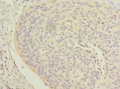KRT33B / Keratin 33B / KRTHA3B Antibody