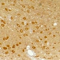 GABRA3 Antibody