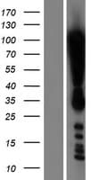 DOT1L / DOT1 Protein (Over-Expression Lysate Myc-DDK (Flag))