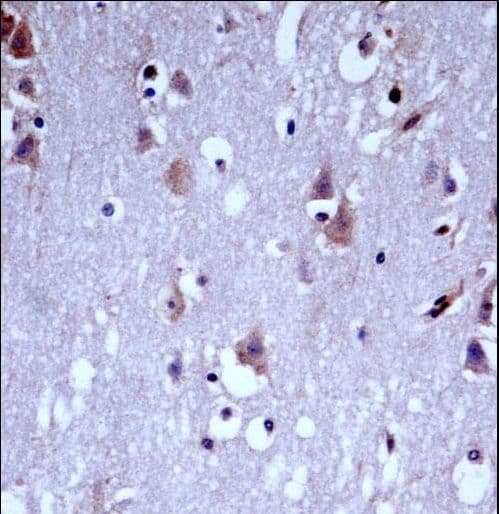 KCNC1 / Kv3.1 Antibody (aa479-508)