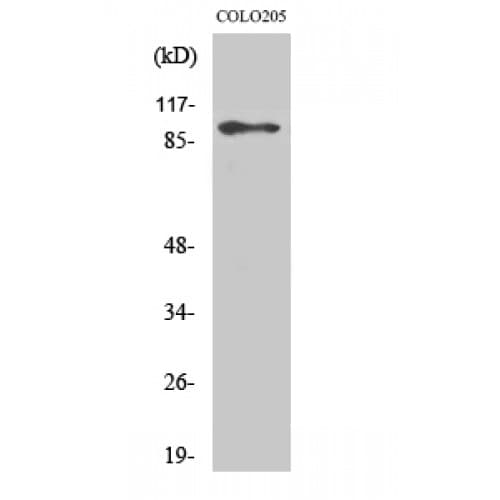 Polyclonal Rabbit anti-Human DP97 / DDX54 Antibody (570-650 aa, Internal, WB)