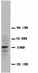 CALB2 / Calretinin Antibody (N-Terminus)