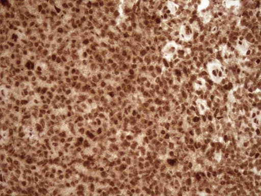 NUDT21 Antibody (aa2-227, clone OTI5B3)