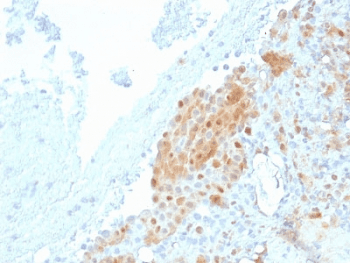 CALB2 / Calretinin Antibody (clone CALB2/2685, Ready-to-Use)