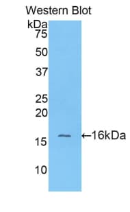 GPT / Alanine Transaminase Antibody (aa16-64)