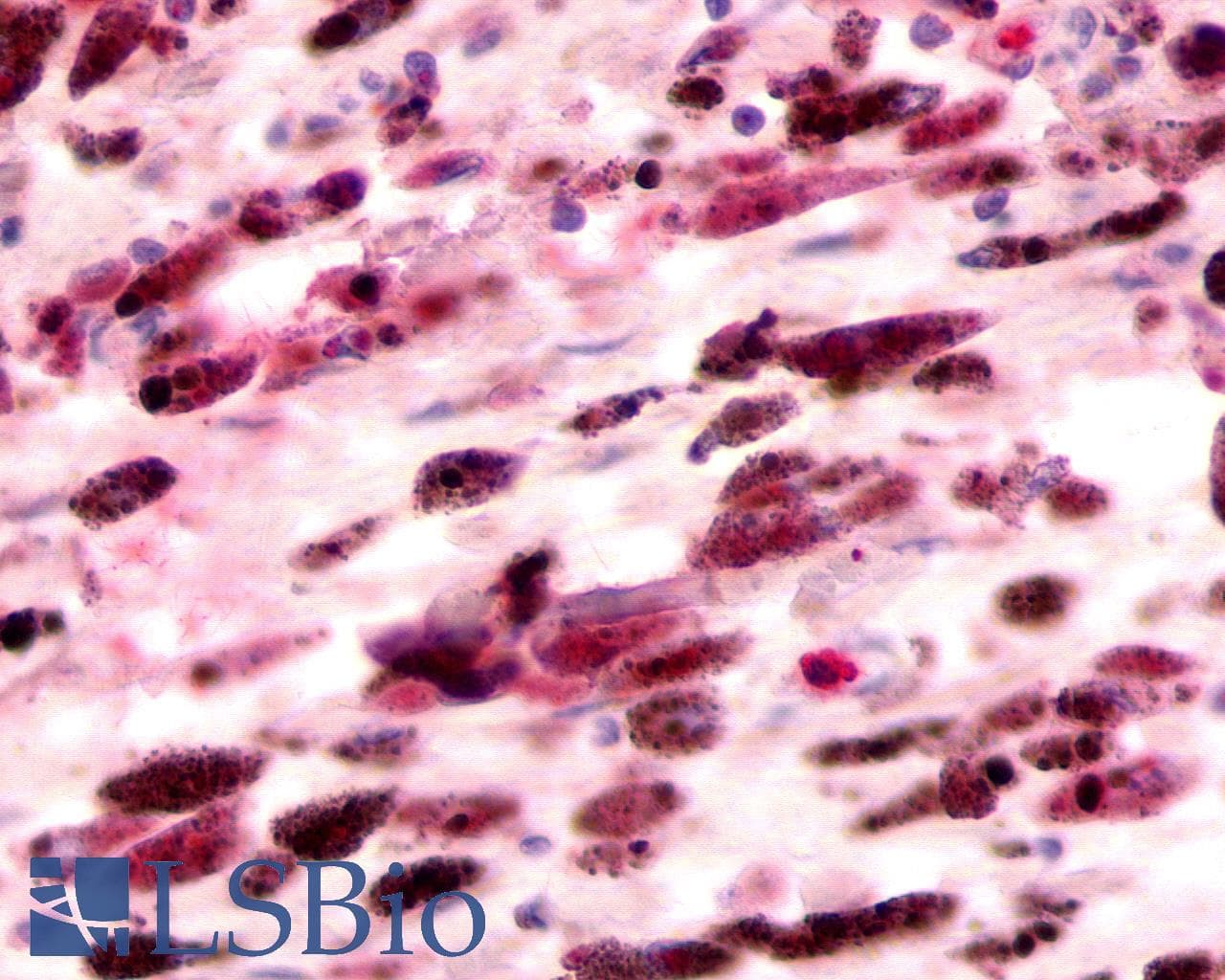 PathPlus™ Polyclonal Rabbit anti-Human FKSG80 / GPR81 Antibody (Extracellular Domain, IHC)