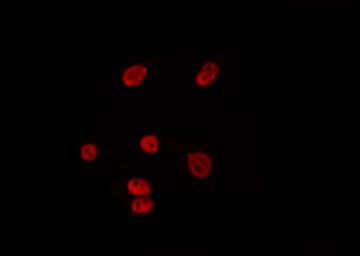 RFC2 / RFC40 Antibody