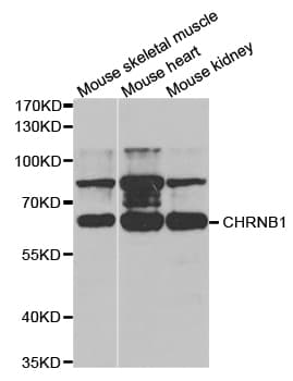 CHRNB1 Antibody