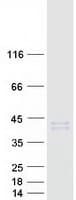 Human HSD11B1 / HSD11B Protein (Recombinant Myc-DDK (Flag))