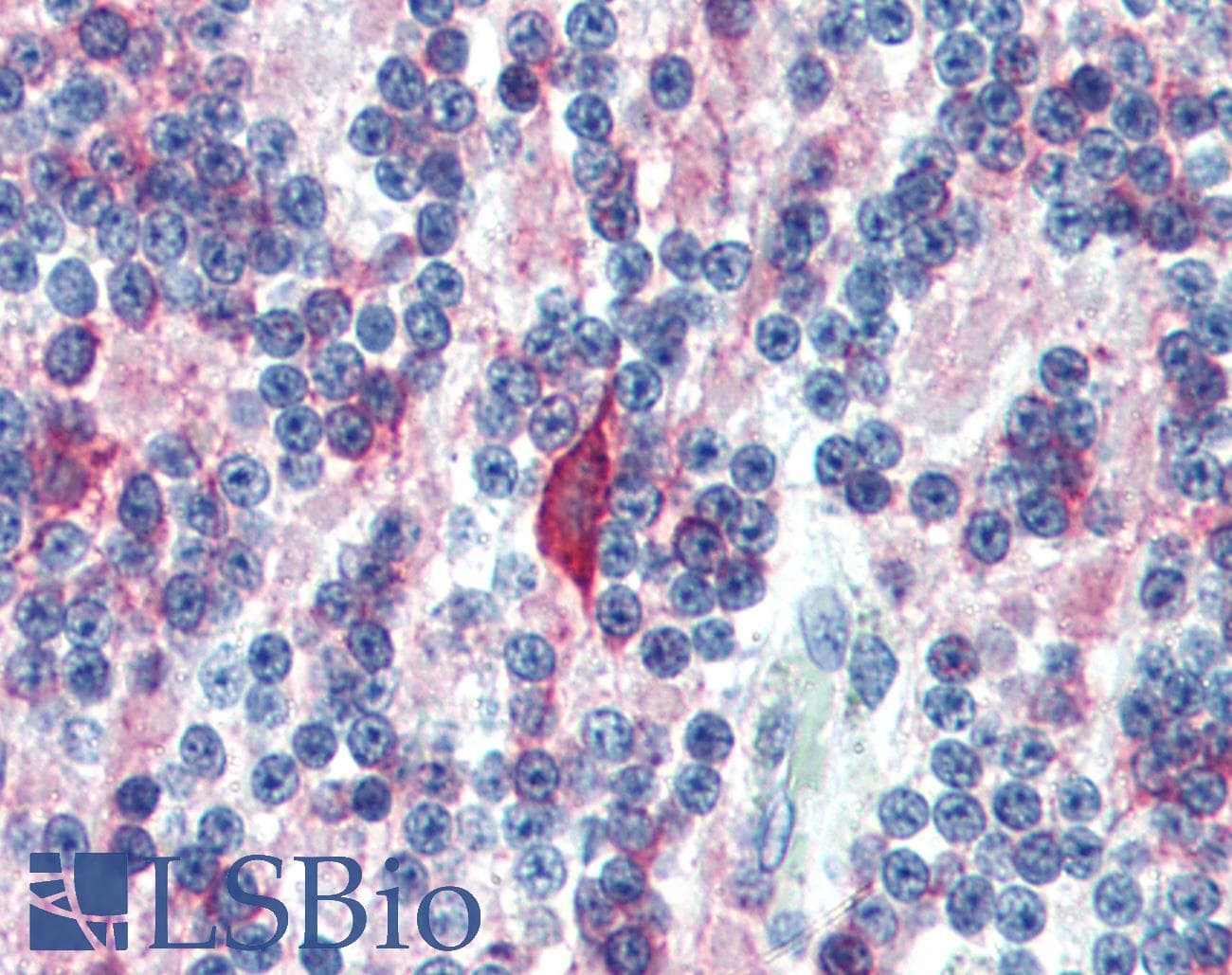 PathPlus™ MAP2 Antibody (clone 5F9)
