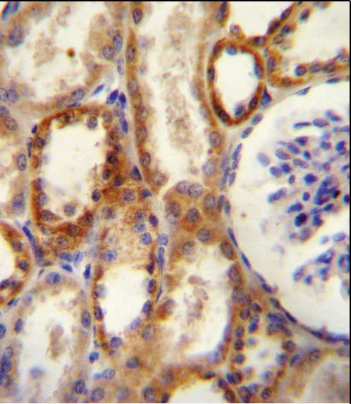 NT5E / eNT / CD73 Antibody (aa1-30)