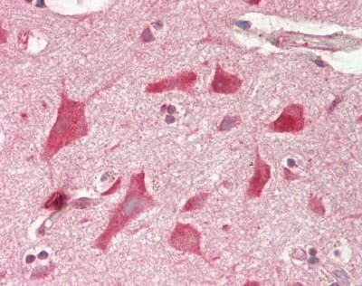 IHC-plus™ Polyclonal Rabbit anti-Human EEA1 Antibody (N-Terminus, IHC, WB)