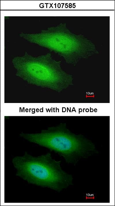 PSKH1 Antibody (aa1-218)