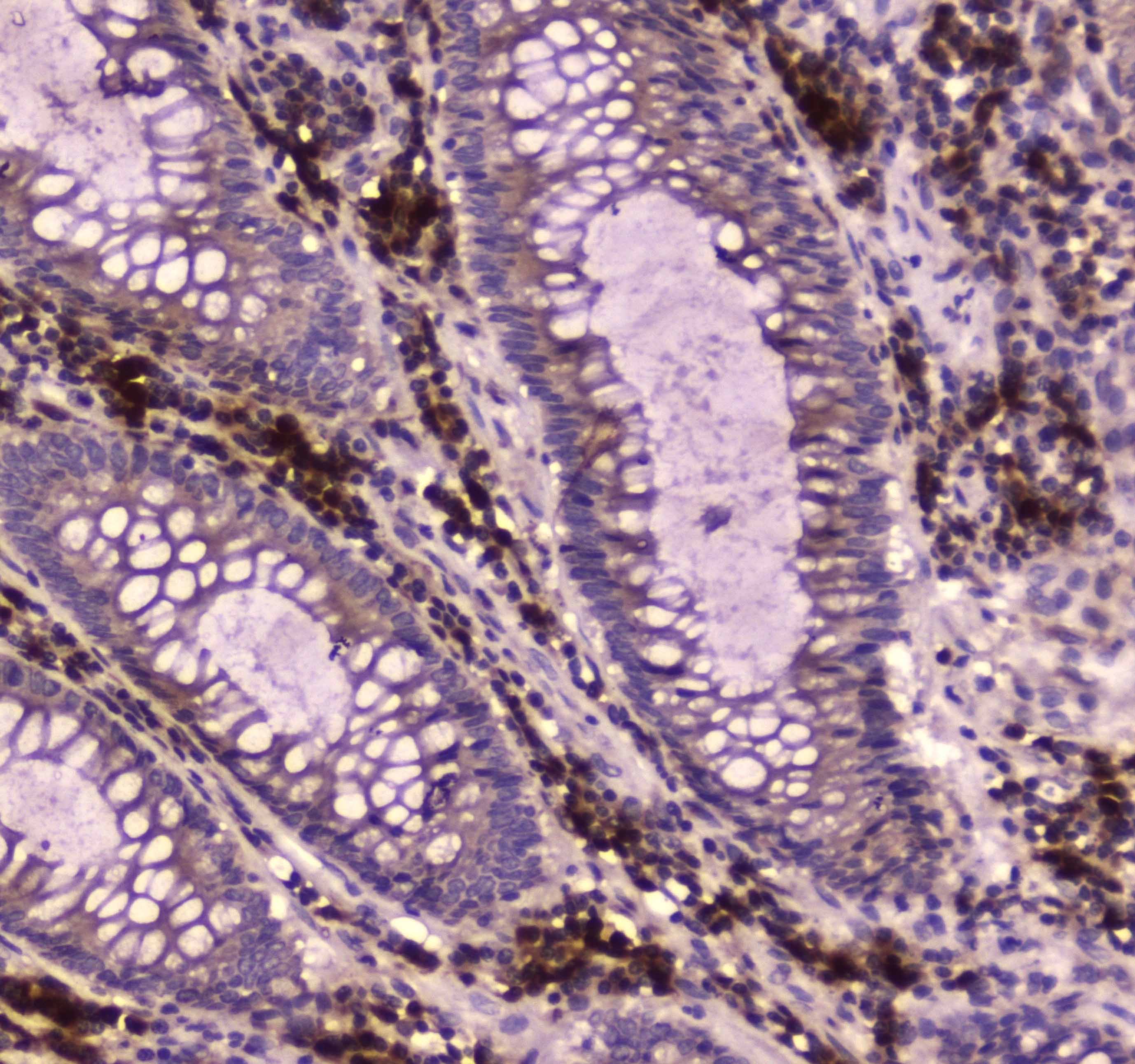 IGF2R / CD222 Antibody