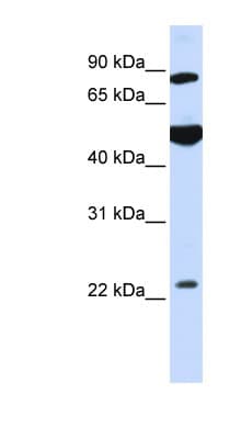 GCS1 / MOGS Antibody (aa144-193)