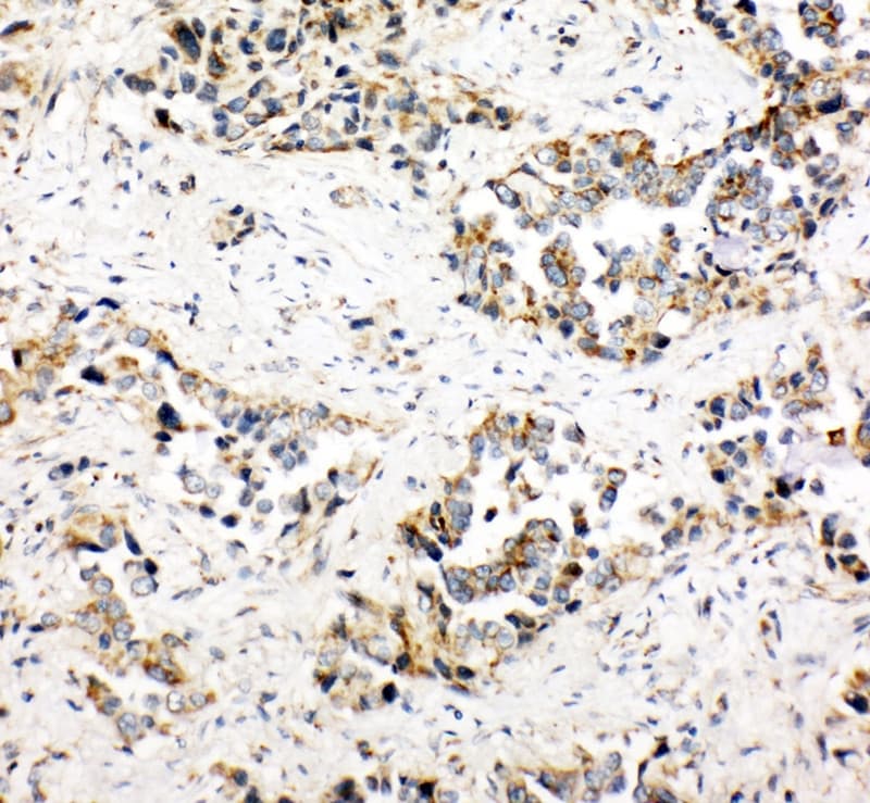 Polyclonal Rabbit anti-Human NDUFA1 Antibody (aa54-70, IHC, WB)