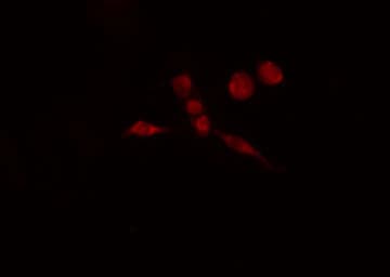 ATF7 Antibody