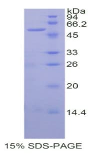 Human SIAE Protein (Recombinant His-GST)