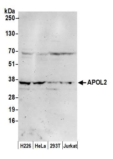 APOL2 / Apolipoprotein L 2 Antibody (aa287-337)