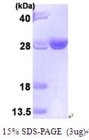 Human UBE2T / HSPC150 Protein (Recombinant His)