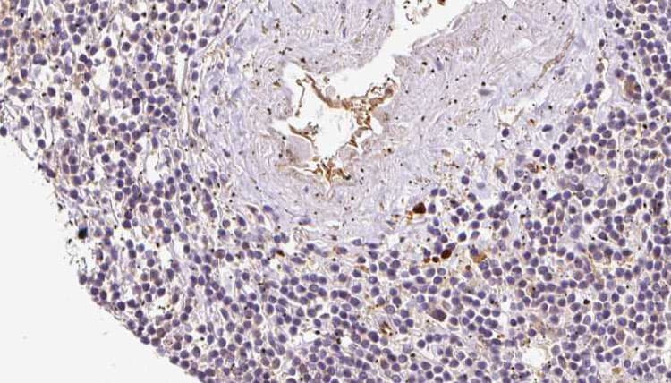 RCN2 Antibody