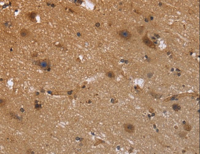 FRK Antibody