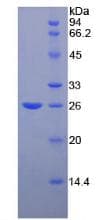 Mouse FBLN2 / Fibulin 2 Protein (Recombinant His)