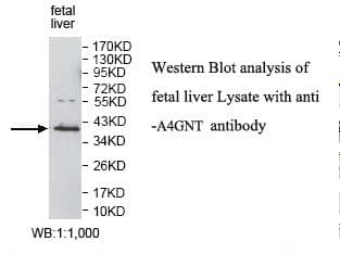 Alpha4GnT / A4GNT Antibody (aa96-318)