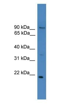 FOXM1 Antibody (N-Terminus)