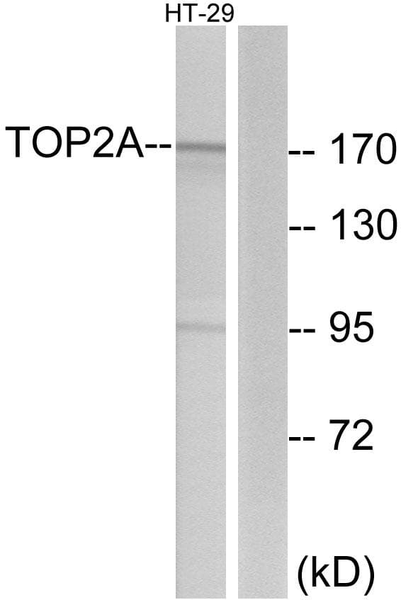Polyclonal Rabbit anti-Human TOP2A / Topoisomerase II Alpha Antibody (IHC, IF, WB)