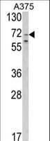SLC23A2 / SVCT2 Antibody (aa2-30)