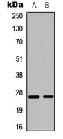 CMPK / CMPK1 Antibody (N-Terminus)