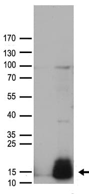 Polyclonal Rabbit anti-Human GUCA2A / Guanylin Antibody (WB)