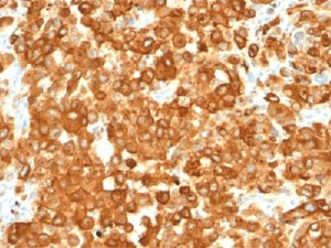 HMB45 Antibody (clone HMB45, Ready-to-Use)