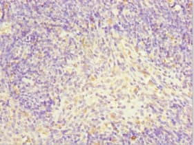 Polyclonal Rabbit anti-Human TFCP2 / CP2 Antibody (IHC, WB)