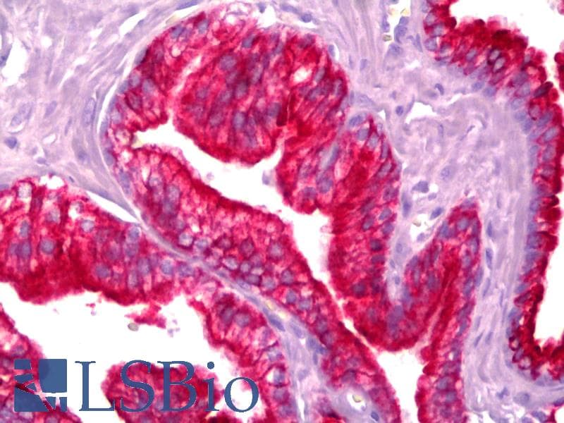 IHC-plus™ KRT18 / CK18 / Cytokeratin 18 Antibody (clone DC-10, FITC)