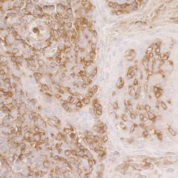 ACTR2 / ARP2 Antibody (aa25-75)