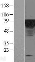 Epsin 1 / EPN1 Protein (Over-Expression Lysate Myc-DDK (Flag))