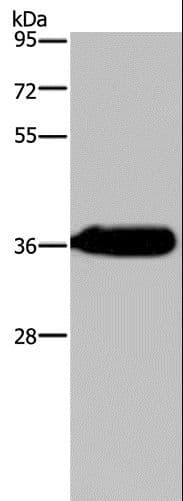 Polyclonal Rabbit anti-Human HSD17B13 Antibody (IHC, WB)