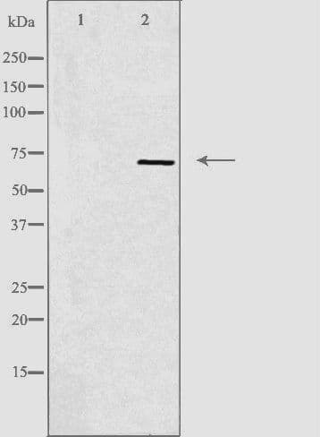 RPS6KB1 / P70S6K / S6K Antibody