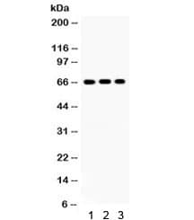 Polyclonal Rabbit anti-Human CRY1 Antibody (WB)