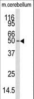 CAMKK1 Antibody (aa86-121)