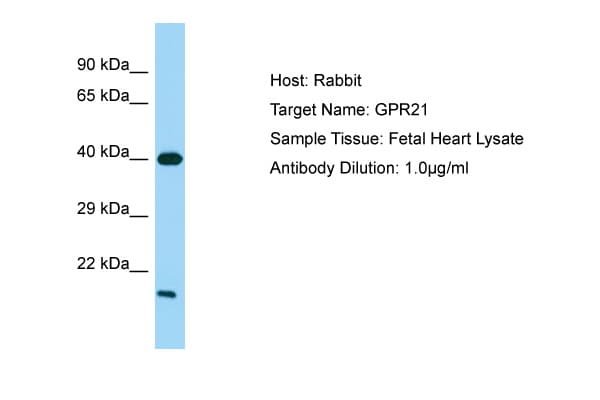 Polyclonal Rabbit anti-Human GPR21 Antibody (aa215-264, IHC, WB)